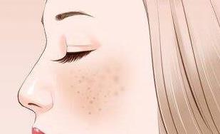 如何去除臉上的斑?最簡(jiǎn)單有效祛斑的方法
