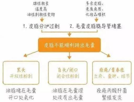 北京伊美爾幸福醫(yī)院:閉口粉刺會自己慢慢消失嗎?