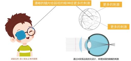 暖視丨專為兒童打造的成長型遠(yuǎn)視鏡片