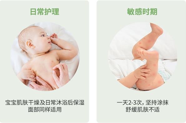 夏季嬰兒濕疹反復發(fā)作的解決方略|嬰兒身體乳選對了嗎?
