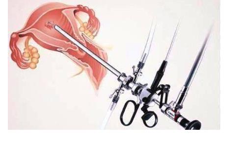 宮腔鏡檢查大概多少錢 宮腔鏡檢查的4大注意事項(xiàng)