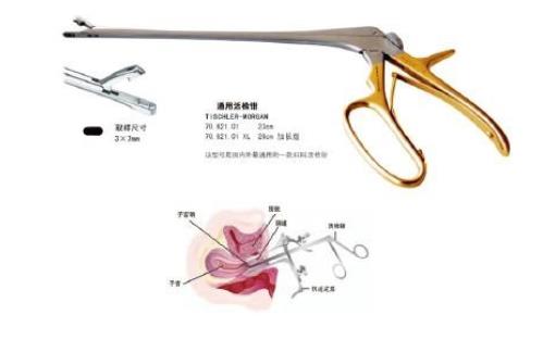 宮頸活檢費(fèi)用是多少 宮頸活檢的注意事項(xiàng)
