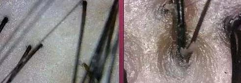 你知道頭皮的真實狀況嗎?青逸植發(fā)告訴你:發(fā)質(zhì)不好是因為