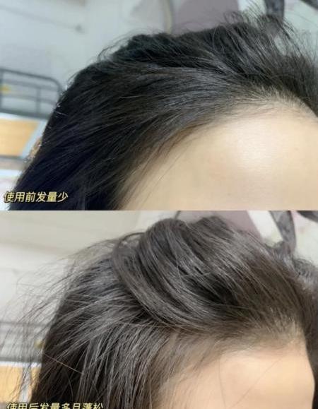 人一天掉多少頭發(fā)?解決脫發(fā)問題原來靠這招!