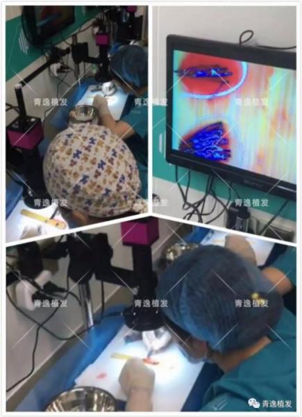 實(shí)力青逸,技術(shù)“植”播于2019年3月10號(hào)在深圳青逸植發(fā)醫(yī)院舉行