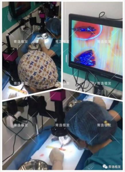 實(shí)力青逸,技術(shù)“植”播于2019年3月10號(hào)在深圳青逸植發(fā)醫(yī)院舉行
