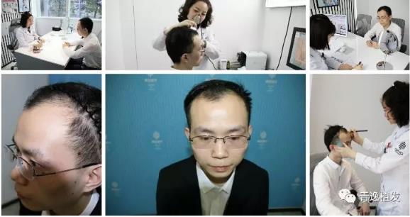 在深圳青逸植發(fā)醫(yī)院舉辦的實力青逸,技術(shù)“植”播圓滿成功