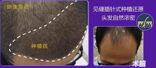 品質(zhì)見證,“植”擊精彩 2019韓妃首屆發(fā)友會圓滿落幕!