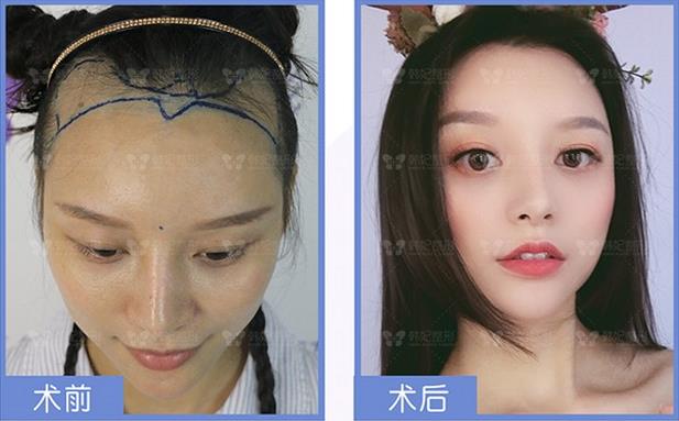 廣州韓妃植發(fā)名家趙進——一生只做一件事,專注植發(fā)