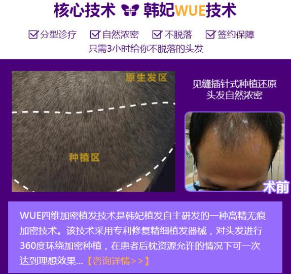 廣州韓妃植發(fā)名家趙進——一生只做一件事,專注植發(fā)