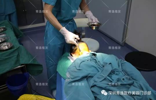 青逸植發(fā)醫(yī)院眾多醫(yī)生跟專家一同見(jiàn)證青逸咨詢助理唯唯的完美蛻變