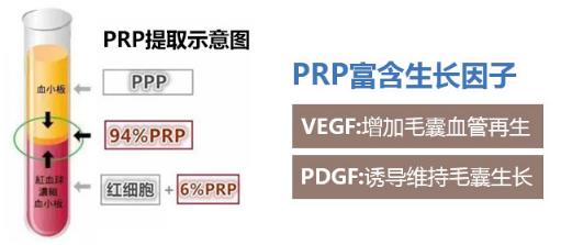 中家醫(yī)家庭醫(yī)生專家姜金豆——資深專家團(tuán)隊·植發(fā)實力派