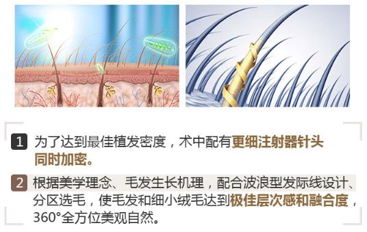 中家醫(yī)家庭醫(yī)生專家姜金豆——資深專家團(tuán)隊·植發(fā)實力派