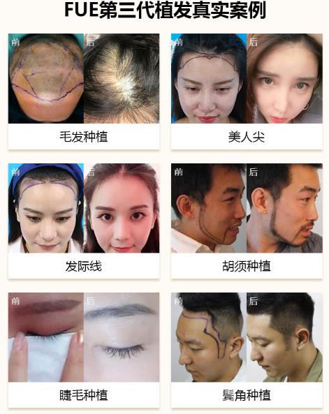 中家醫(yī)家庭醫(yī)生專家姜金豆——資深專家團(tuán)隊·植發(fā)實力派