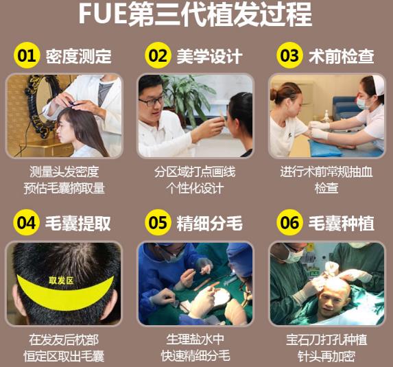 中家醫(yī)家庭醫(yī)生專家姜金豆——資深專家團(tuán)隊·植發(fā)實力派