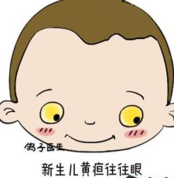 膽結(jié)石病人飲食要注意 4種食物是禁忌