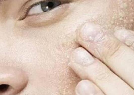男人也有內(nèi)分泌失調(diào)的時(shí)候 5大癥狀需警惕