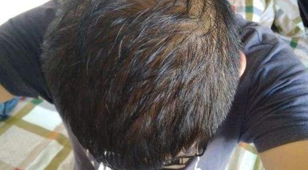 男人如果腎虛的話就會(huì)導(dǎo)致性能力下降 男人腎虛的6大癥狀
