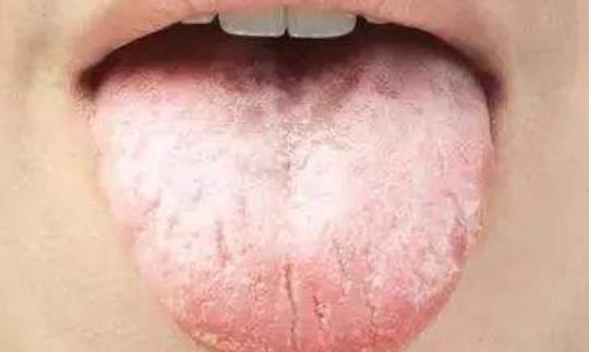 口臭怎么預防 推薦8個妙招