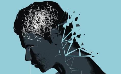 男性脫發(fā)的原因有哪些 職場(chǎng)壓力該怎么緩解