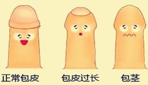 男人為什么要割包皮?割包皮前要注意事項(xiàng) 割包皮后注意事項(xiàng)