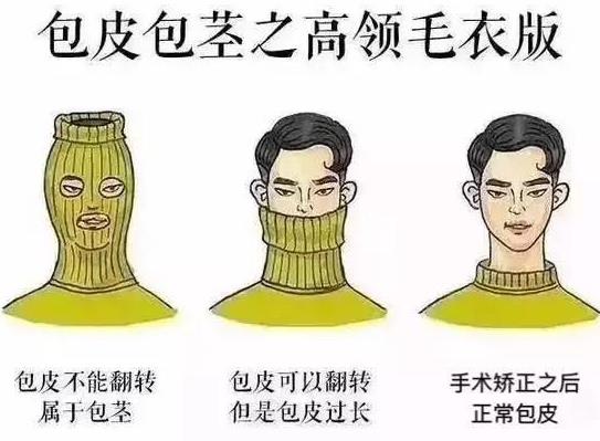 男人為什么要割包皮?割包皮前要注意事項(xiàng) 割包皮后注意事項(xiàng)
