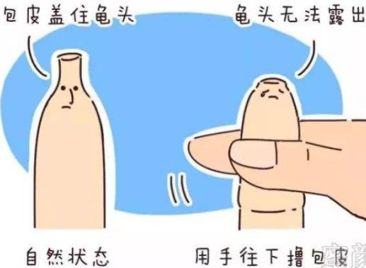 男人為什么要割包皮?割包皮前要注意事項(xiàng) 割包皮后注意事項(xiàng)