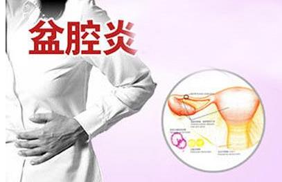 盆腔炎有什么癥狀?盆腔炎是怎么引起的