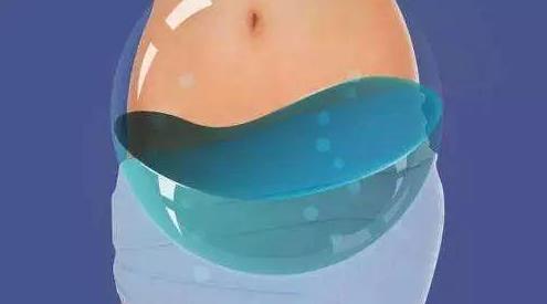 盆腔化膿是怎么引起的?盆腔化膿的癥狀