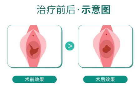 成都市哪些醫(yī)院可以修復(fù)處女膜