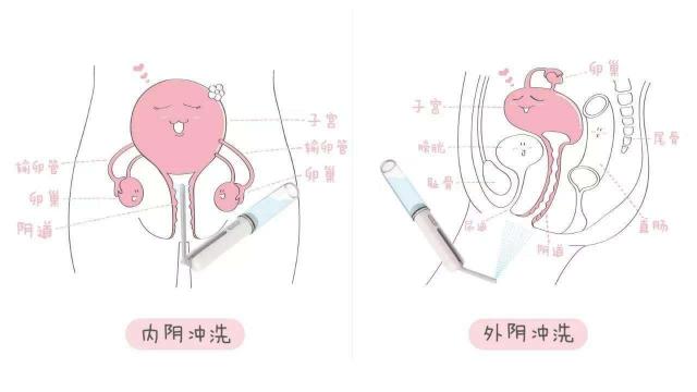 ŮꎵʲôӵĈDƬ ꎲ挍(sh)(gu)ʽY(ji)(gu)D