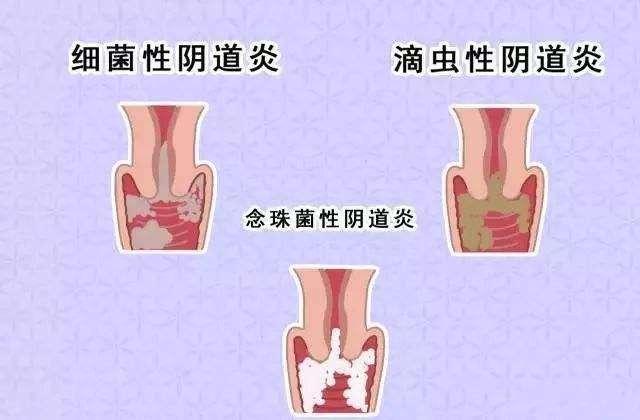 ŮʲôӵĈDƬ ꎲ挍(sh)(gu)ʽY(ji)(gu)D