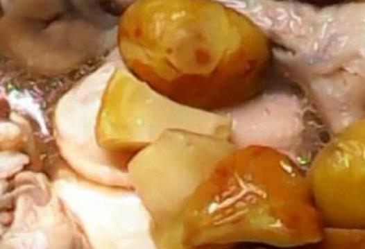 女性比男性更需要補(bǔ)腎 推薦2種女人能夠保護(hù)腎臟的食療方