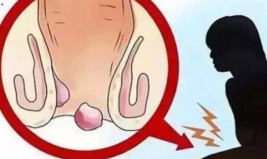 女生出現(xiàn)便秘很難受 推薦8種女性預(yù)防便秘的方法