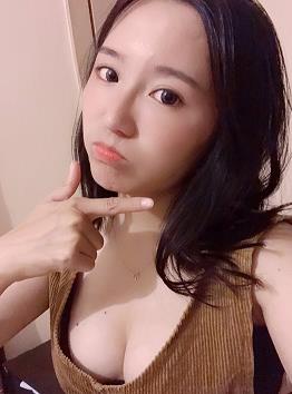 我完美蛻變的秘密——韋元強濃縮脂肪豐胸