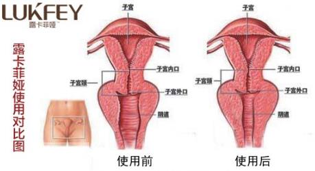 女人縮陰用什么藥最好,五步告訴你最好的產(chǎn)品!