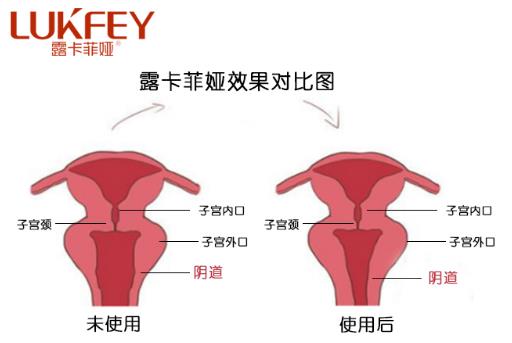 私護(hù)產(chǎn)品什么品牌好,首選國(guó)家最安全的私護(hù)產(chǎn)品