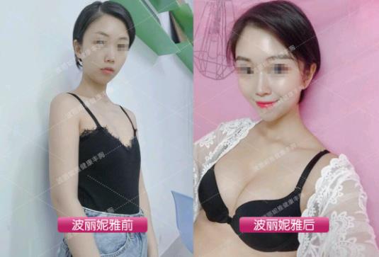 胸小怎么才能變大 怎么做才能快速豐胸