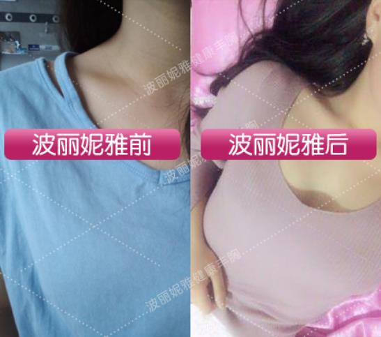 波麗妮雅用多久有效果 看看真實客戶的用戶反饋