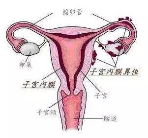 呼市五洲醫(yī)院治病靠譜嗎?子宮內(nèi)膜薄造成的不孕不育原因是什么