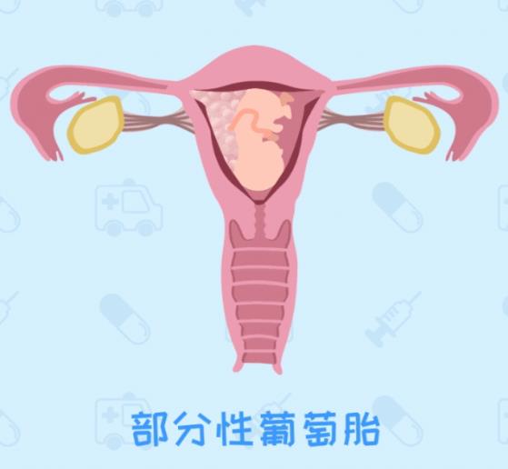 呼和浩特五洲醫(yī)院看病專業(yè)嗎 HCG升高一定是懷孕嗎不可能還有詐