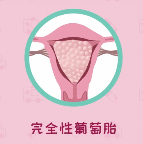 呼和浩特五洲醫(yī)院看病專業(yè)嗎 HCG升高一定是懷孕嗎不可能還有詐