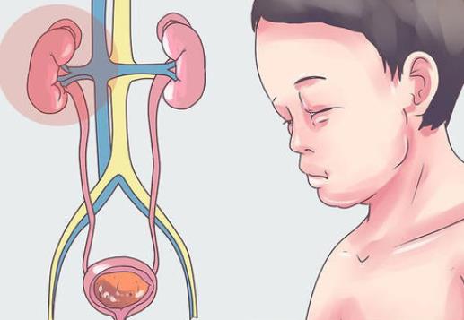 腎病綜合癥可以生孩子嗎?腎病綜合癥患者懷孕要點