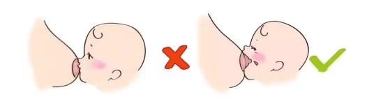 康哺樂®母乳益生菌預(yù)防、緩解哺乳期乳腺炎,全程守護母嬰健康!