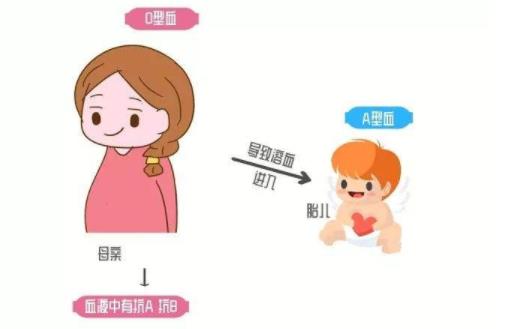母兒血型不合溶血病 母兒血型不合的注意事項(xiàng)