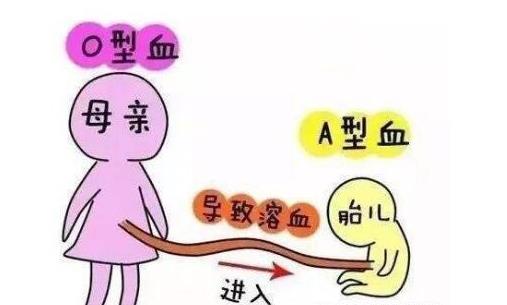 母兒血型不合溶血病 母兒血型不合的注意事項(xiàng)