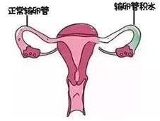 重慶送子鳥關(guān)懷健康行,孕路援助暖心間
