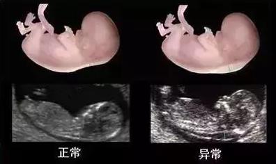 做四維去哪個(gè)醫(yī)院好?天津天孕醫(yī)院技術(shù)專業(yè)