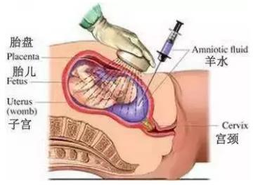 做四維去哪個(gè)醫(yī)院好?天津天孕醫(yī)院技術(shù)專業(yè)