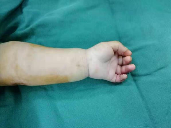 北京愛康醫(yī)療集團(tuán)怎么樣?骨科專家溫馨提醒:家有幼兒,一定要小心這個(gè)“隱形”兇器